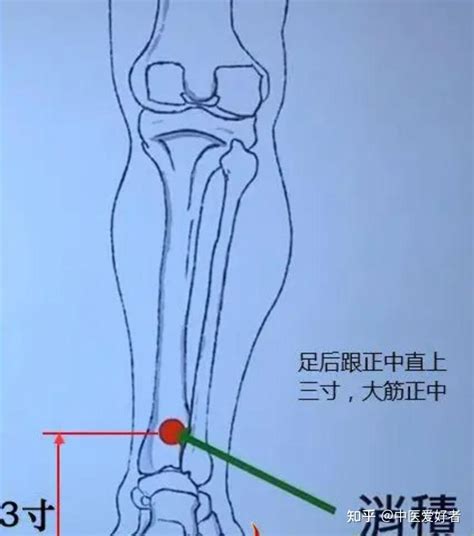 消積穴 癸己